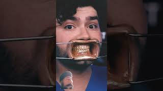 Gold vs Silver ASMR Brush Battle #dentaldigest #Braces#FaTGLoB#shortvideo