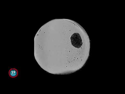 Tracking spheroid and organoid growth with the CytoSMART Omni