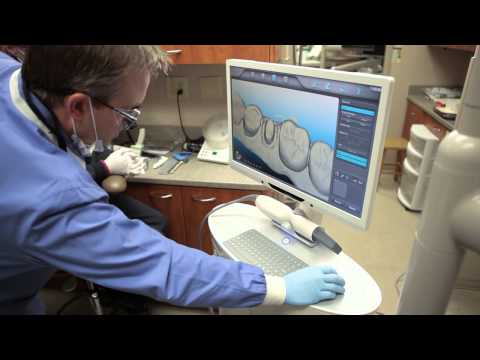 iTero Scanner and Dental Crown Benefits