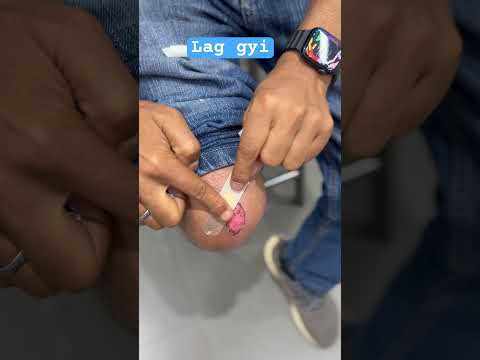 Bandage kaise lgaye #punjabisong #newsong #firstaid #bandage #medical #applynow #lgao #reels