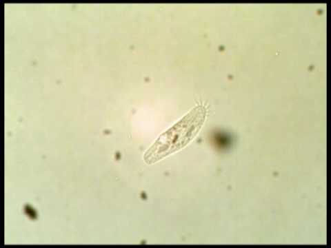 Unknow Spirotrichea