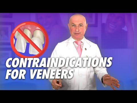 Contraindications for Veneers: When Not to Choose Veneers