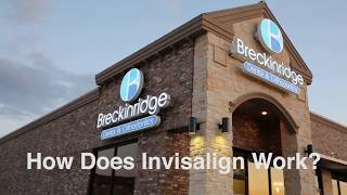 FAQ - How does invisalign work? | Breckinridge Dental & Orthodontics