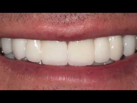 Cometic Dentistry -  Dr. Michael Kosdon - Cosmetic Dentist - Manhattan, New York
