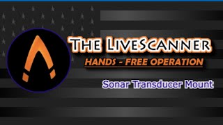 The Livescanner: 5 Month Review!!! Likes and Dislikes