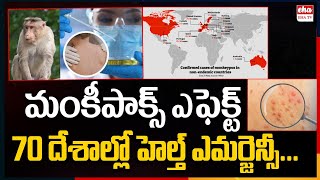 Monkeypox Virus: Causes, Symptoms and Precautions to be taken | Health | WHO | EHA TV