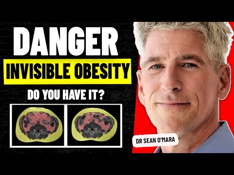 Unseen Epidemic: How Visceral Fat Leads to Chronic Disease | Dr Sean O'Mara