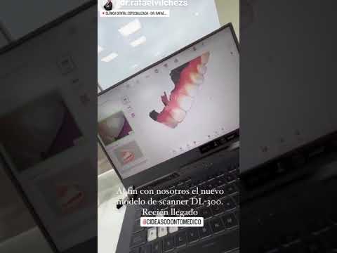 Launca DL-300P Intraoral Scanner in Dental Clinic by Dr. Rafaelvilchezs