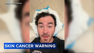 Kevin Jonas gets surgery to remove basal cell carcinoma skin cancer