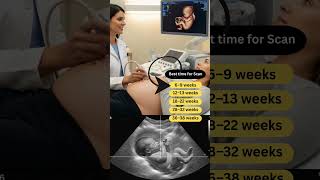 Best Time for Ultrasound Scan | Week-by-Week Pregnancy Ultrasound Guide
