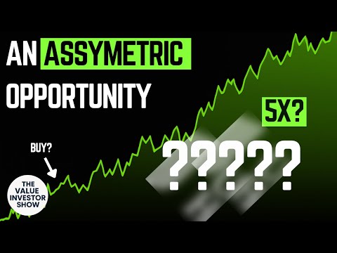 This Stock Is So UNDERVALUED. I'm Buying?