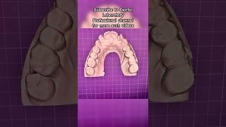 Dental bridge #dentalbridge #dentist #crownandbridge #bds #mds #prosthodontics #prosthodontist #dent