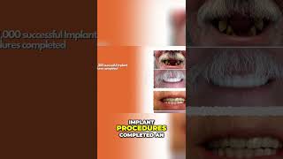 Incredible Dental Transformations - See the Results! 🦷✨