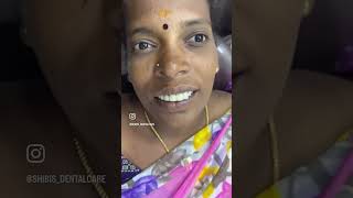 #tamildentist  #bestdentalclinicchennai #dentistinchennai #dentalwork #smilemakeover