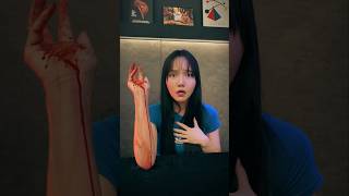 손바닥 피 결과