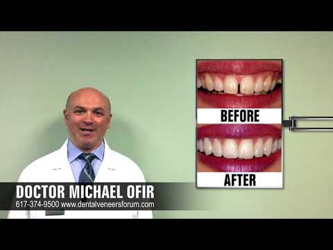 Veneers and Lumineers