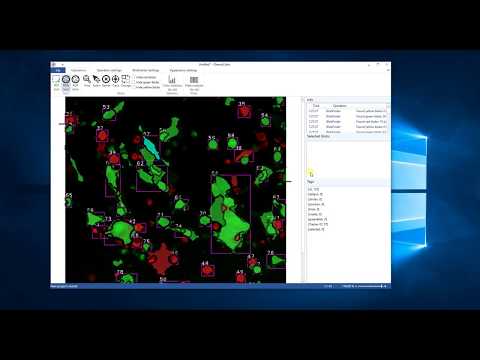 Chemo Color Projekt Osteoclast Sejt Követési Funkcióinak Bemutatása