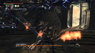 Loran Camerabeast shocks a Scrublord