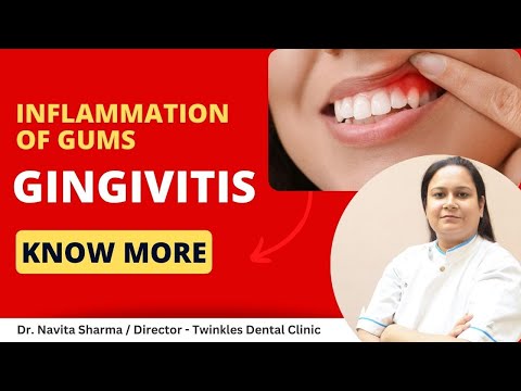 Gingivitis क्या है ? | Treatment of Gingivitis | Dr. Navita Sharma