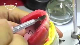 Denture Teeth Setting