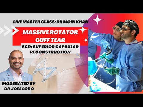 Massive Rotator Cuff Tear: (SCR) Superior Capsular Reconstruction - Master Class LIVE