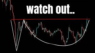REVERSAL NOW! LIVE TRADING GOLD BITCOIN STOCKS