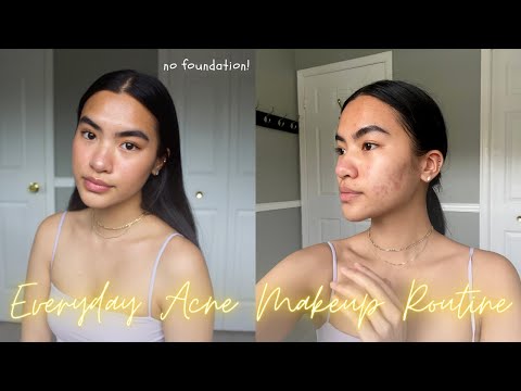 natural everyday acne makeup routine (for acne, textured skin & post inflammatory pigmentation)