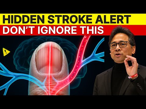These 5 Nail Changes Reveal a Stroke Before It Happens | Dr William Li