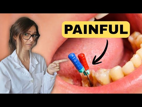 Root Canals Don’t Hurt — But Yours Might