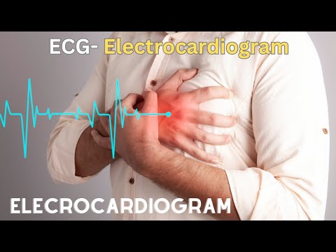 Why ECG (Electrocardiogram) is performed?