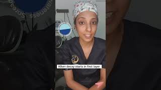 Root Canal Treatment #rootcanalspecialist #dentist #noida #shorts