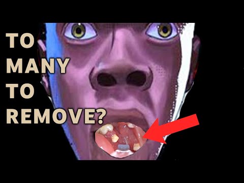We need to talk | AIM 30