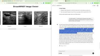 Building a Web-Based Breast Cancer Detection Tool with BreastMNIST & TensorFlow.js