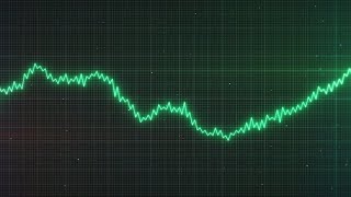 Options Trading: Understanding Option Prices | How Do Options Work?