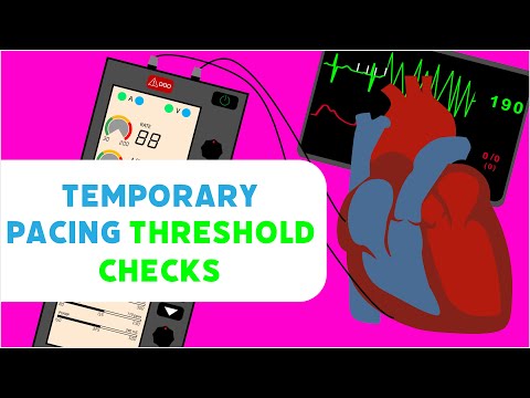 Temporary Pacing Threshold Checks