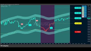 🔴XAUUSD Live 1 Minute Scalping | Gold Live | Real-Time Buy/Sell Signals
