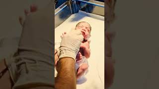 #newborncare #neonatologist #niculife #babyfeeding #newarrivals2025 #cutebaby #pretermbaby #beauty