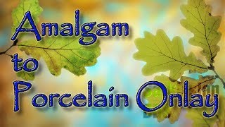 How to Replace a Failing Amalgam Filling with a Porcelain Onlay