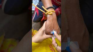 Iv cannulation process