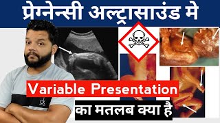 Variable Presentation In Pregnancy Ultrasound | How To Read Pregnancy Usg