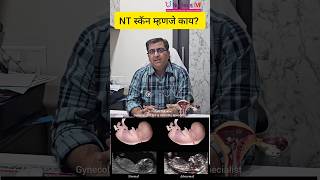 Pregnancy मध्ये करण्यात येणारे NT Scan म्हणजे काय ? | What is NT Scan? @Nucleus-IVF_Dr.Pritam