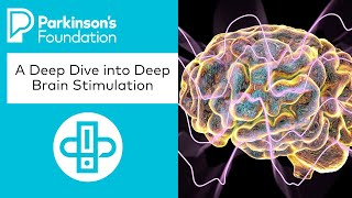 A Deep Dive into Deep Brain Stimulation | Parkinson's Foundation