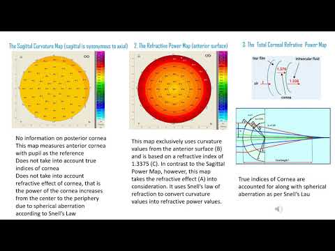Lasik and Different Curvature Maps for IOL Power calculation (Website address : quickguide.org)