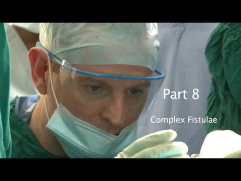 Fistula Video part III