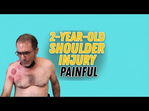 2 year Old Shoulder Injury: Causes limited range of motion and PAINFUL!