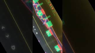 #trading #optionstrading #options #analysis #like