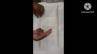 Proper technique of wearing surgical gloves before surgery..