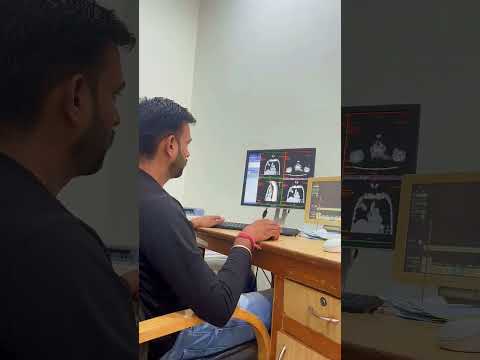 #healthcare #medicine #viralvideo  #radiologytechnician #ctscan #shorts #shortvideo #youtubeshorts