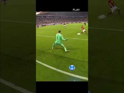 Rolando short leg fracture 🦴 #viral #avee_player