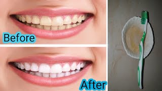 Make dirty yellow teeth white and shiny, kill dental worms and end the do #Shorts